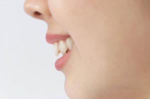 脂肪吸引の効果的な施術後ケアとは？徹底解説