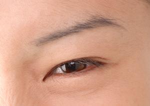 美容整形外科で安全・信頼できる施術を受けるためのポイント